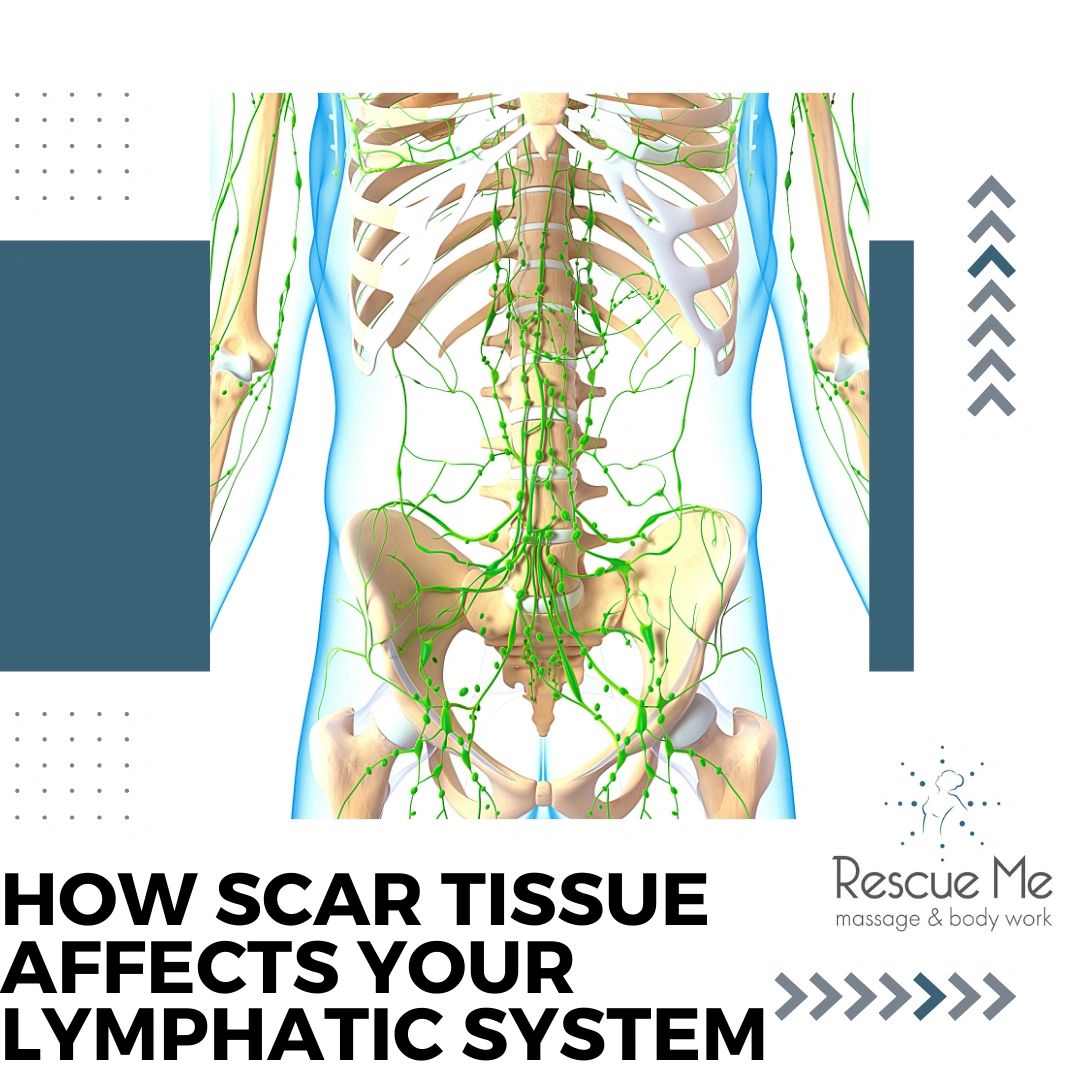 How Scar Tissue Affects Your Lymphatic System